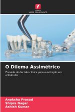 O Dilema Assimétrico