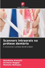 Scanners intraorais na prótese dentária