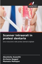 Scanner intraorali in protesi dentaria