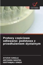 Protezy częściowe odlewane