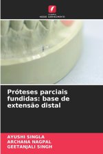 Próteses parciais fundidas