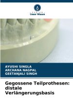 Gegossene Teilprothesen