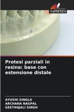 Protesi parziali in resina