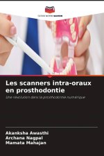 Les scanners intra-oraux en prosthodontie