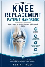 The knee replacement patient handbook