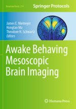 Awake Behaving Mesoscopic Brain Imaging