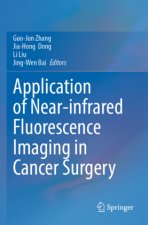 Application of Near-infrared Fluorescence Imaging in Cancer Surgery