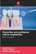 Enxertos em próteses sobre implantes