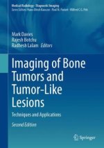 Imaging of Bone Tumors and Tumor-Like Lesions