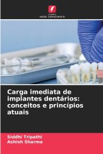 Carga imediata de implantes dentários