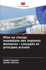 Mise en charge immédiate des implants dentaires