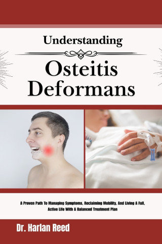 Understanding Osteitis Deformans